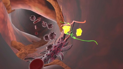 Colon VR-Prevention Lab: in Lombardia la realtà virtuale entra nella prevenzione del tumore al colon-retto